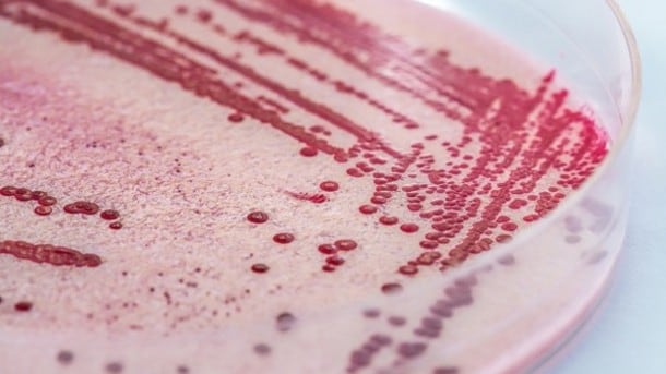Listeria-fear-Kroger-and-Giant-Eagle-recall-sunflower-seed-products_strict_xxl.jpg