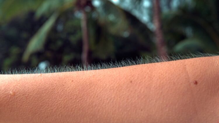 Hair-standing-up-on-an-arm-Getty.jpg
