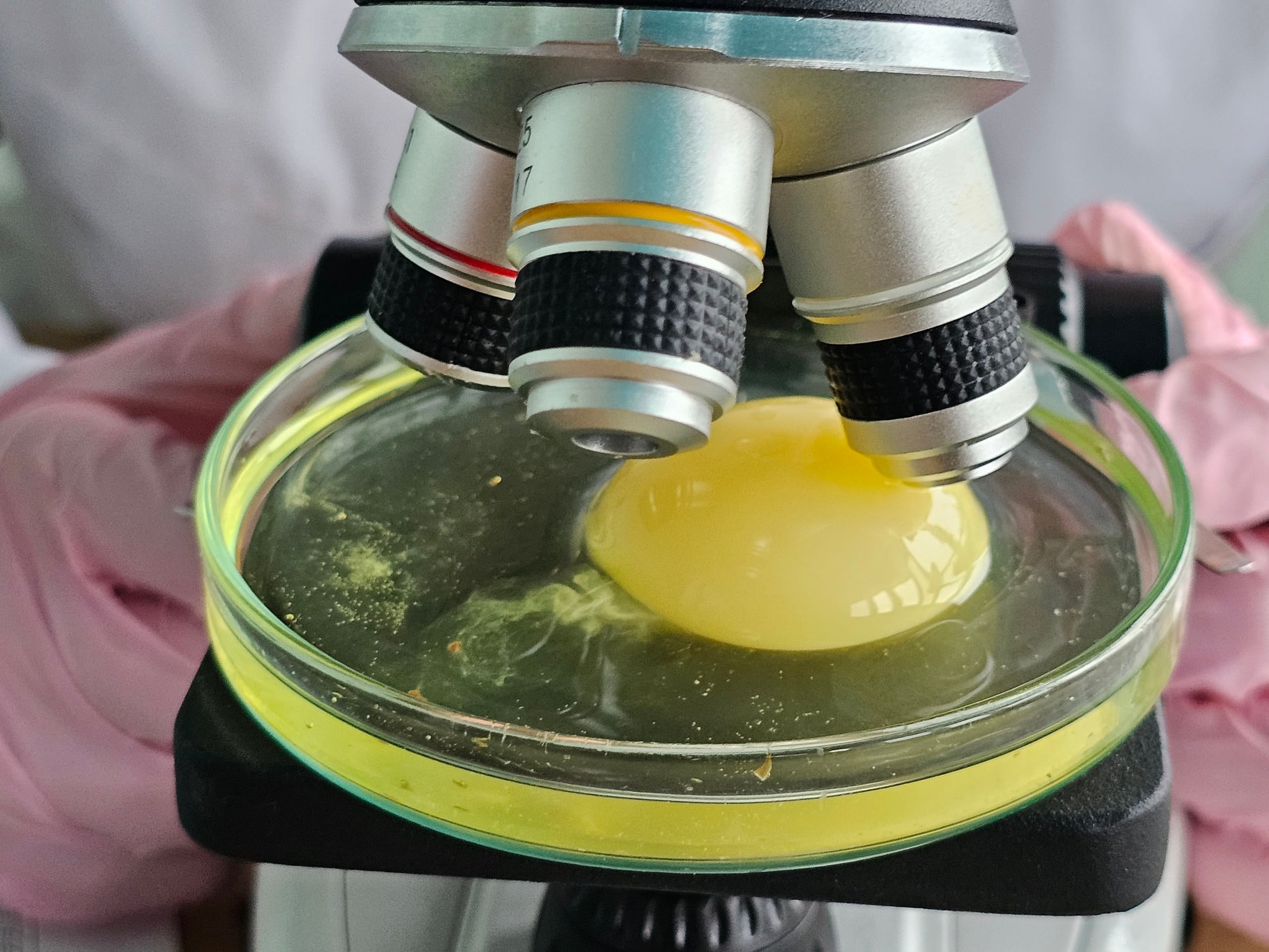 Examining egg through a microscope Nadzeya Haroshka GettyImages