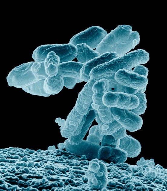 Ecoli-Callista-Images.jpg
