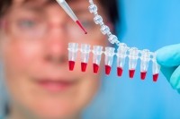 blood sample tests research iStock.com luchschen