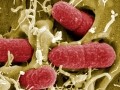 July – EU bans Egyptian seeds after deadly E.coli outbreak